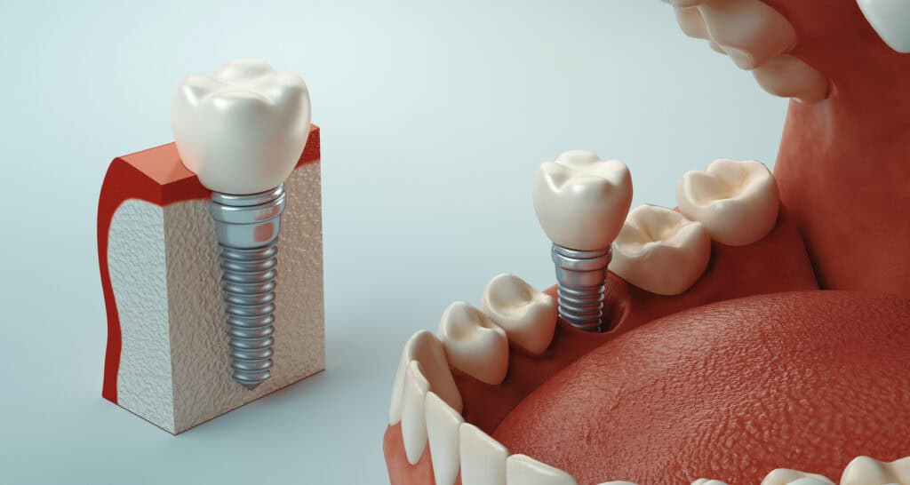 Dental care, 3d rendering
